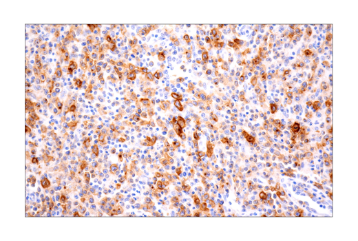 Immunohistochemistry Image 6: TNFRSF8/CD30 (E7E4D) XP® Rabbit mAb (BSA and Azide Free)