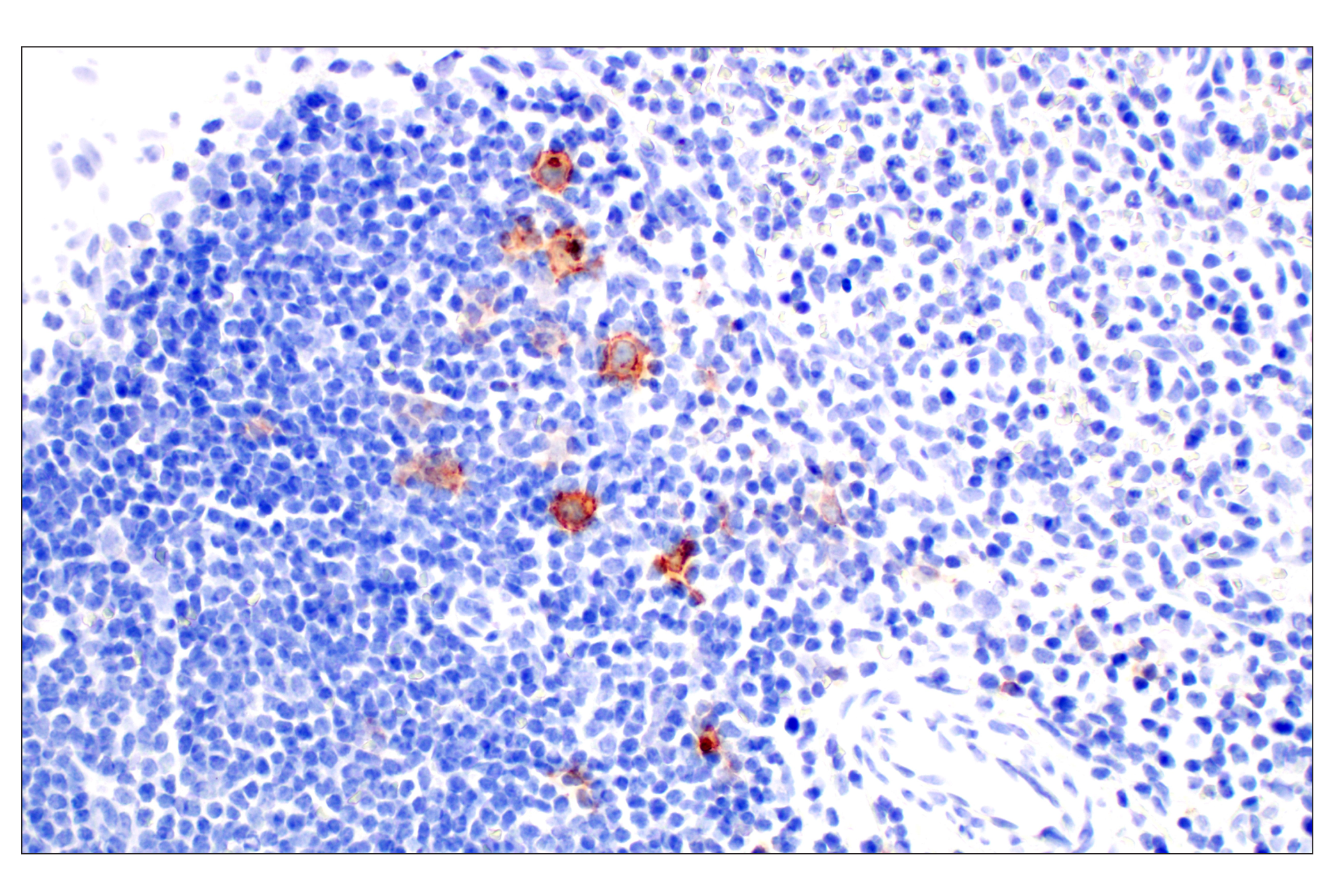 Immunohistochemistry Image 4: TNFRSF8/CD30 (E7E4D) XP® Rabbit mAb (BSA and Azide Free)