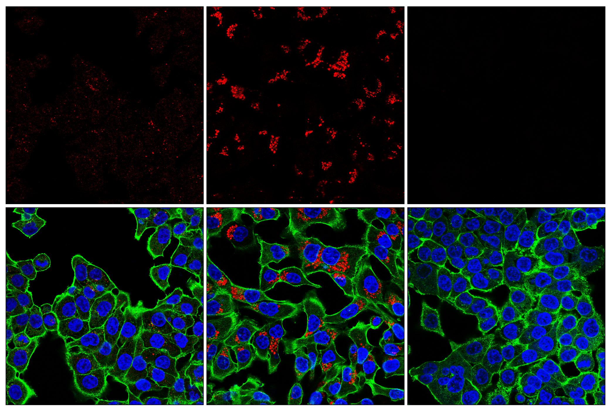 Immunofluorescence Image 2: LC3B (E5Q2K) Mouse mAb (Alexa Fluor® 647 Conjugate)