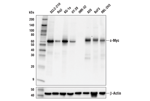  Image 2: PhosphoPlus® c-Myc (Ser62) Antibody Duet
