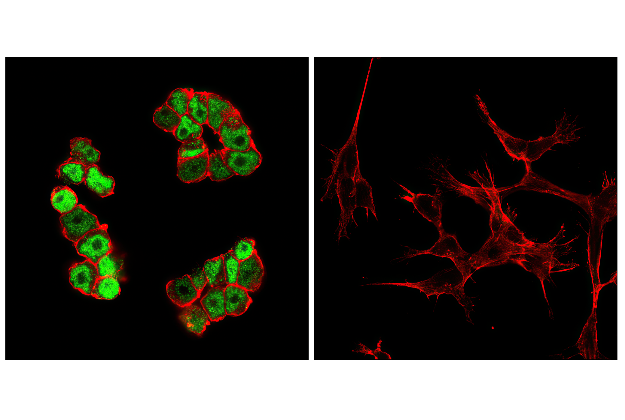 Immunofluorescence Image 1: c-Myc (E5Q6W) Rabbit mAb