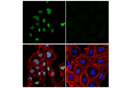 Immunofluorescence Image 1: SIX2 (E7C3J) Rabbit mAb