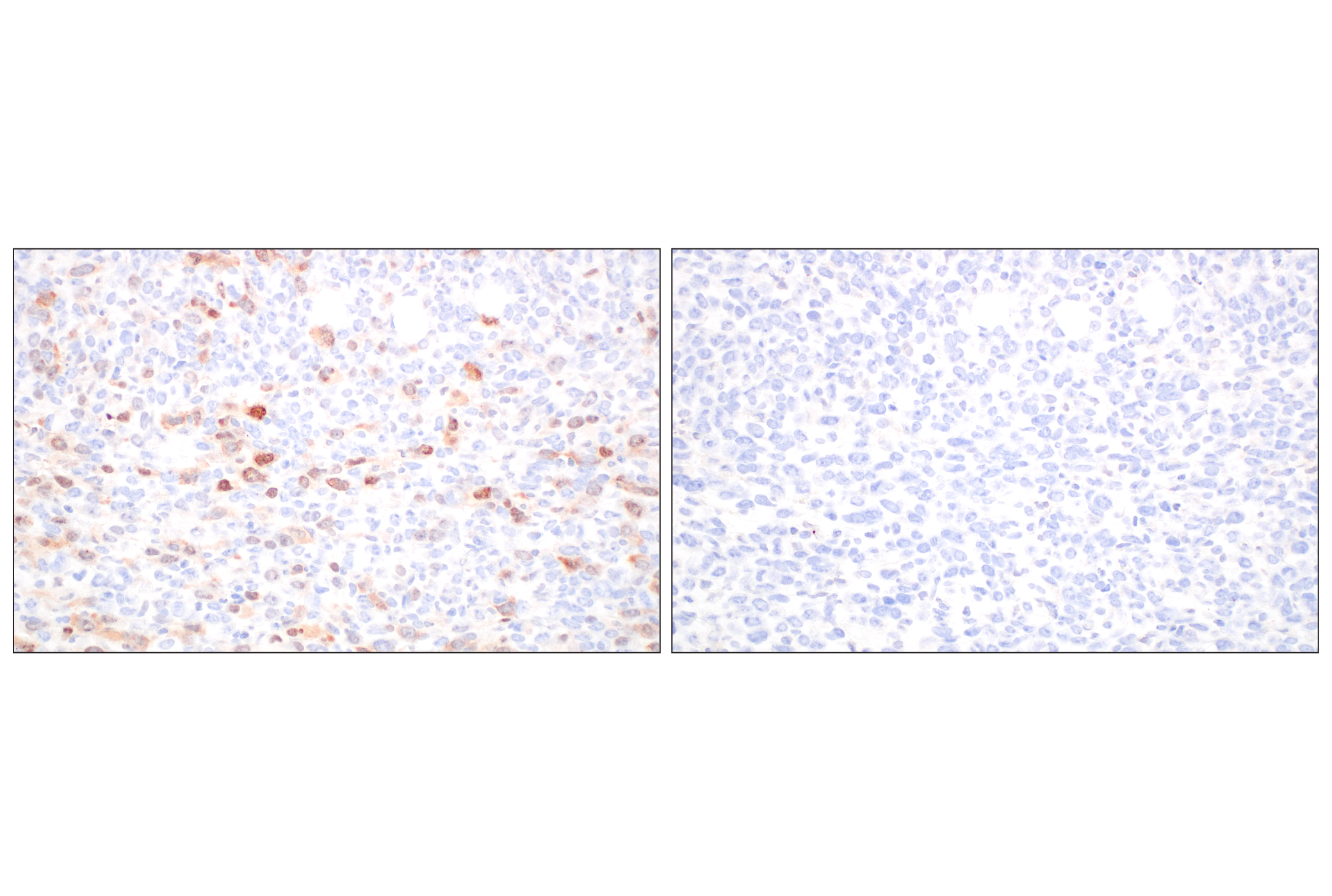 Immunohistochemistry Image 5: Cyclin A2 (E9Q5G) Rabbit mAb (BSA and Azide Free)