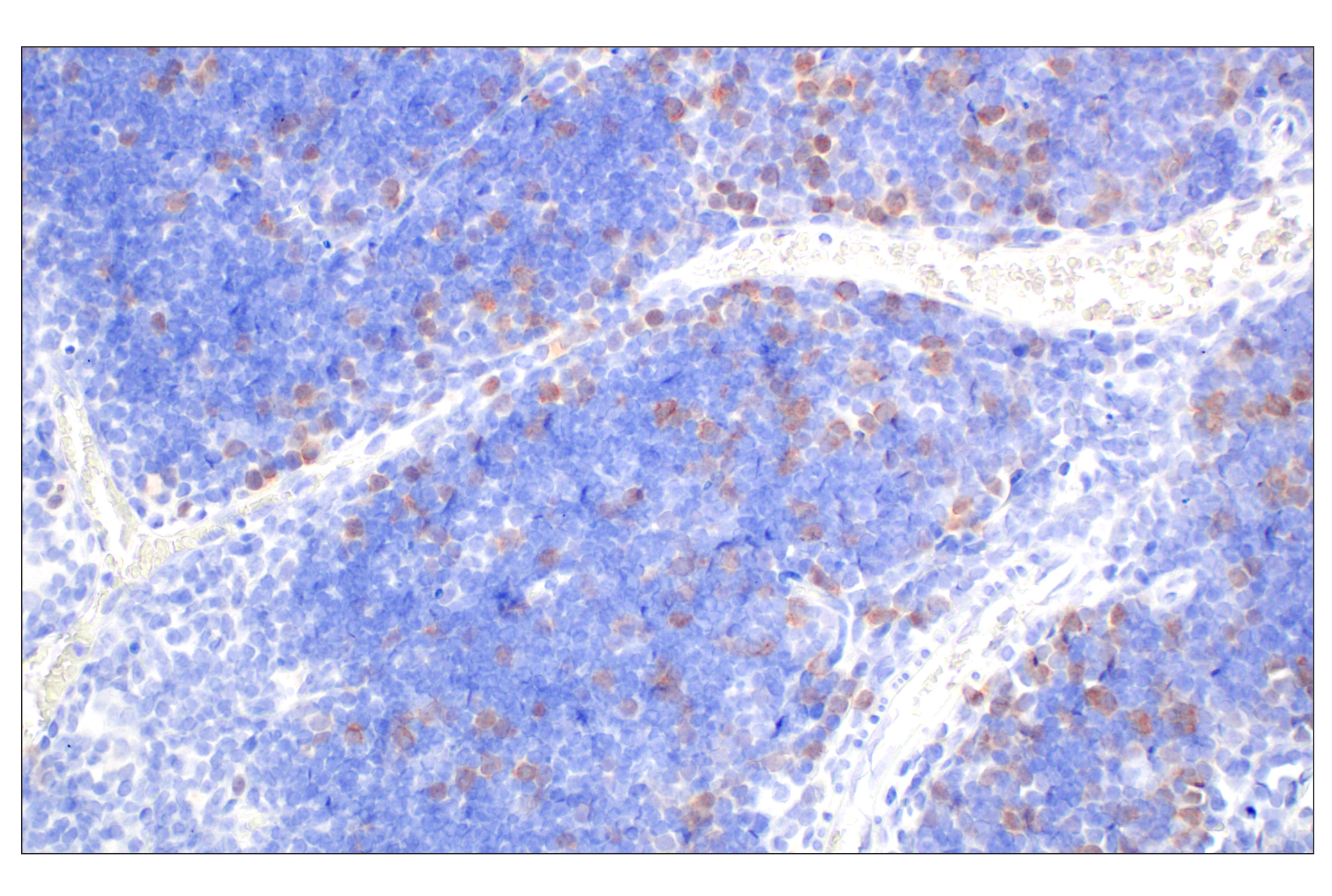 Immunohistochemistry Image 4: Cyclin A2 (E9Q5G) Rabbit mAb (BSA and Azide Free)