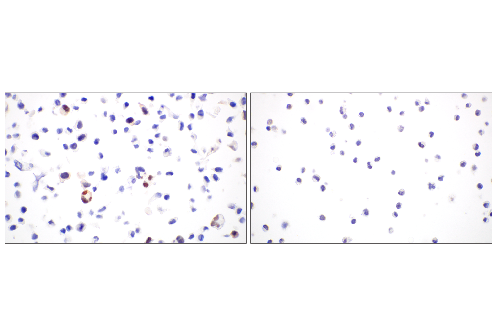 Immunohistochemistry Image 6: Cyclin A2 (E9Q5G) Rabbit mAb (BSA and Azide Free)