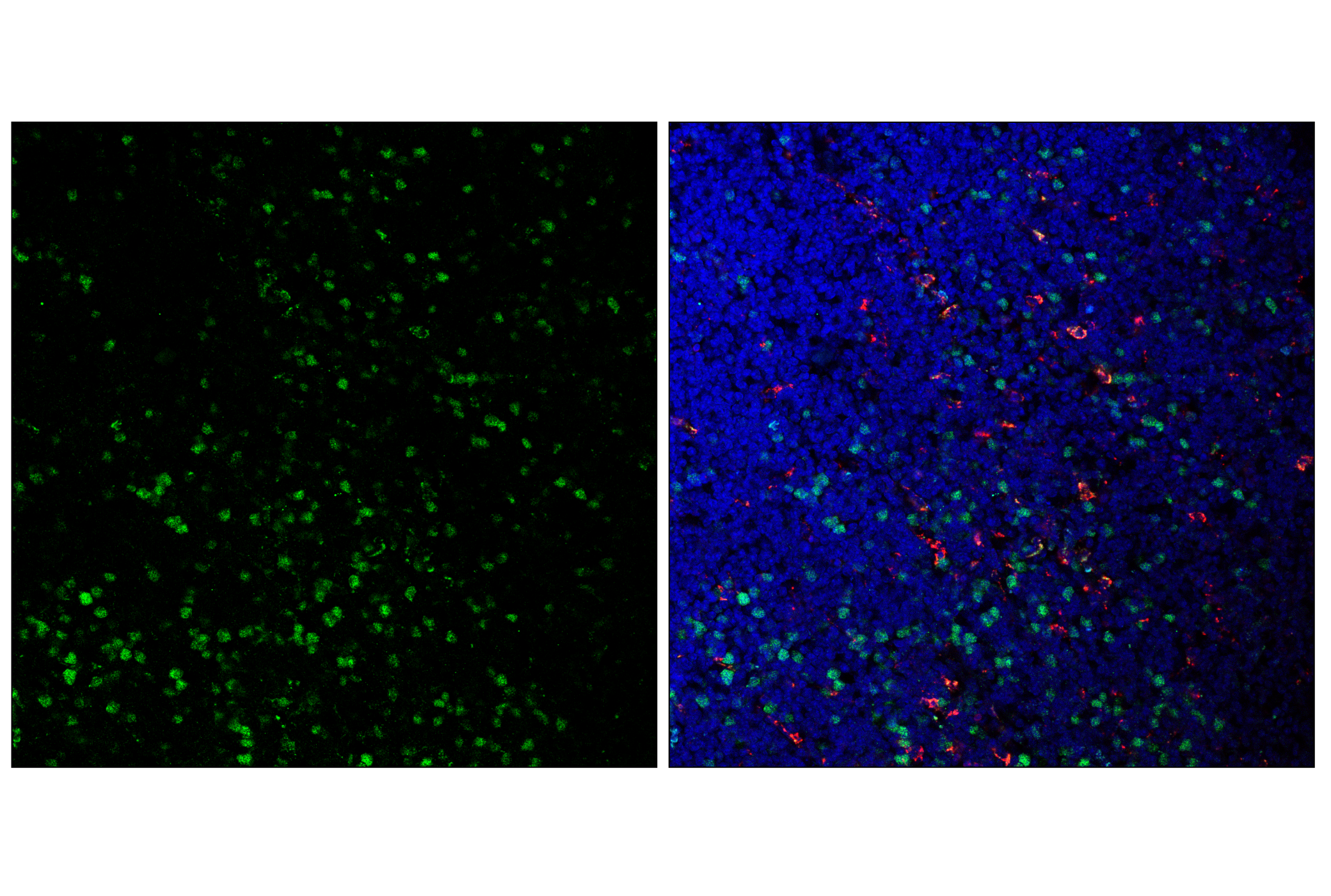 Immunofluorescence Image 1: Cyclin A2 (E9Q5G) Rabbit mAb (BSA and Azide Free)