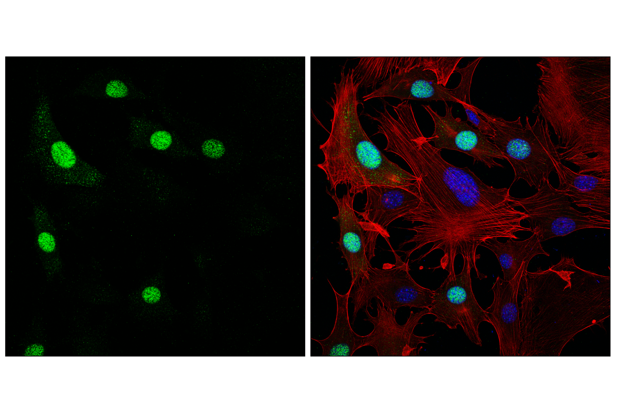 Immunofluorescence Image 3: Cyclin A2 (E9Q5G) Rabbit mAb (BSA and Azide Free)