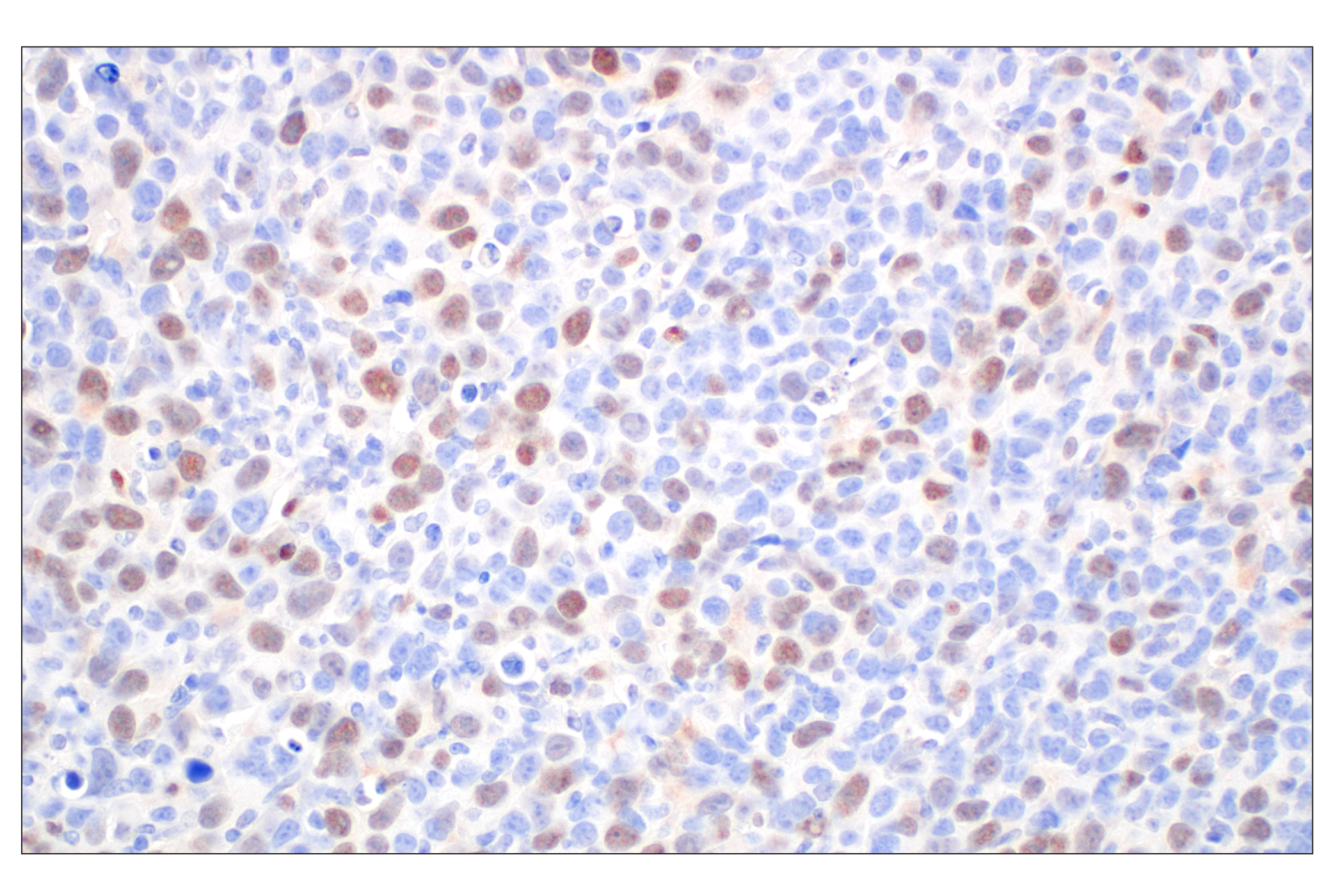 Immunohistochemistry Image 3: Cyclin A2 (E9Q5G) Rabbit mAb (BSA and Azide Free)