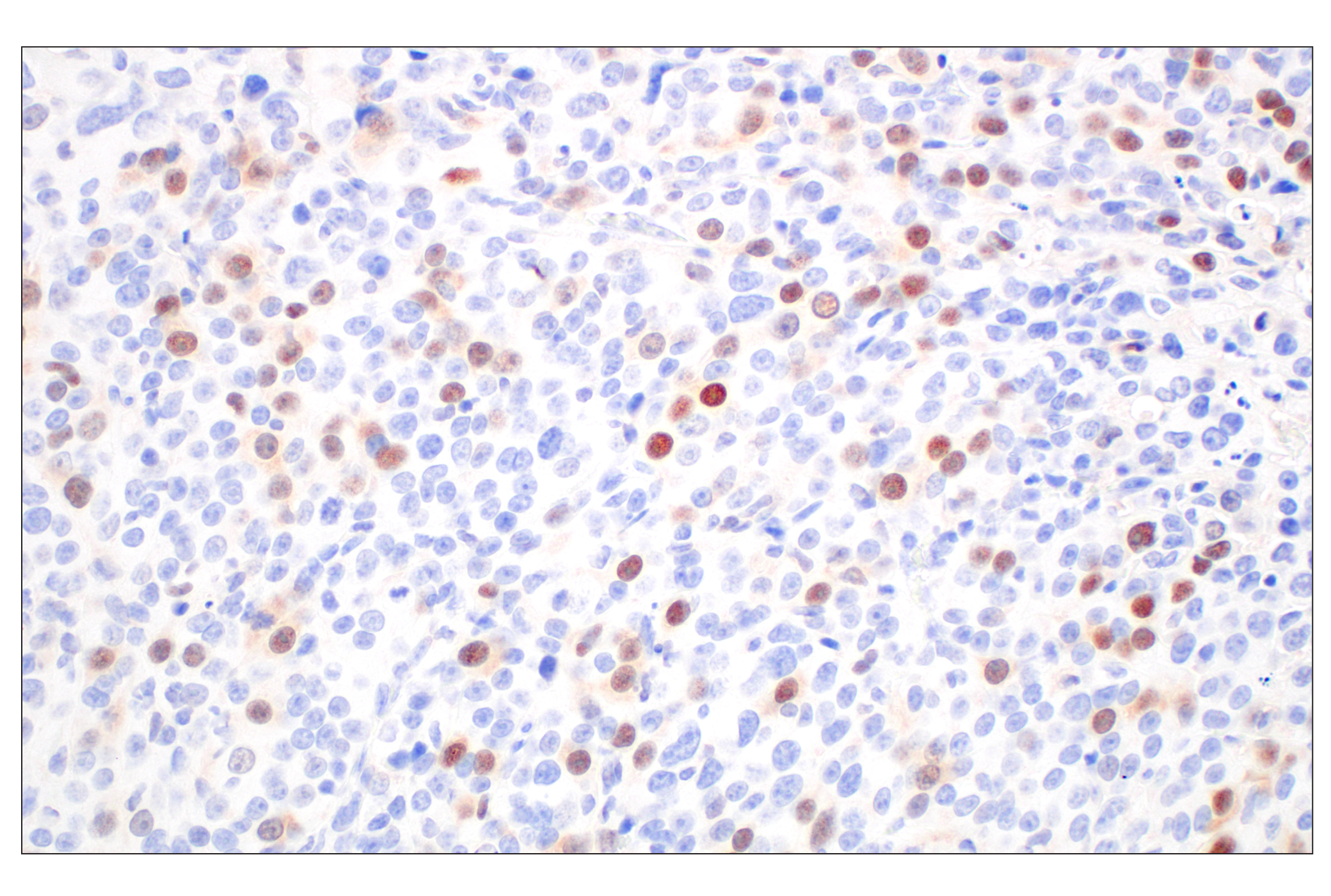 Immunohistochemistry Image 2: Cyclin A2 (E9Q5G) Rabbit mAb (BSA and Azide Free)