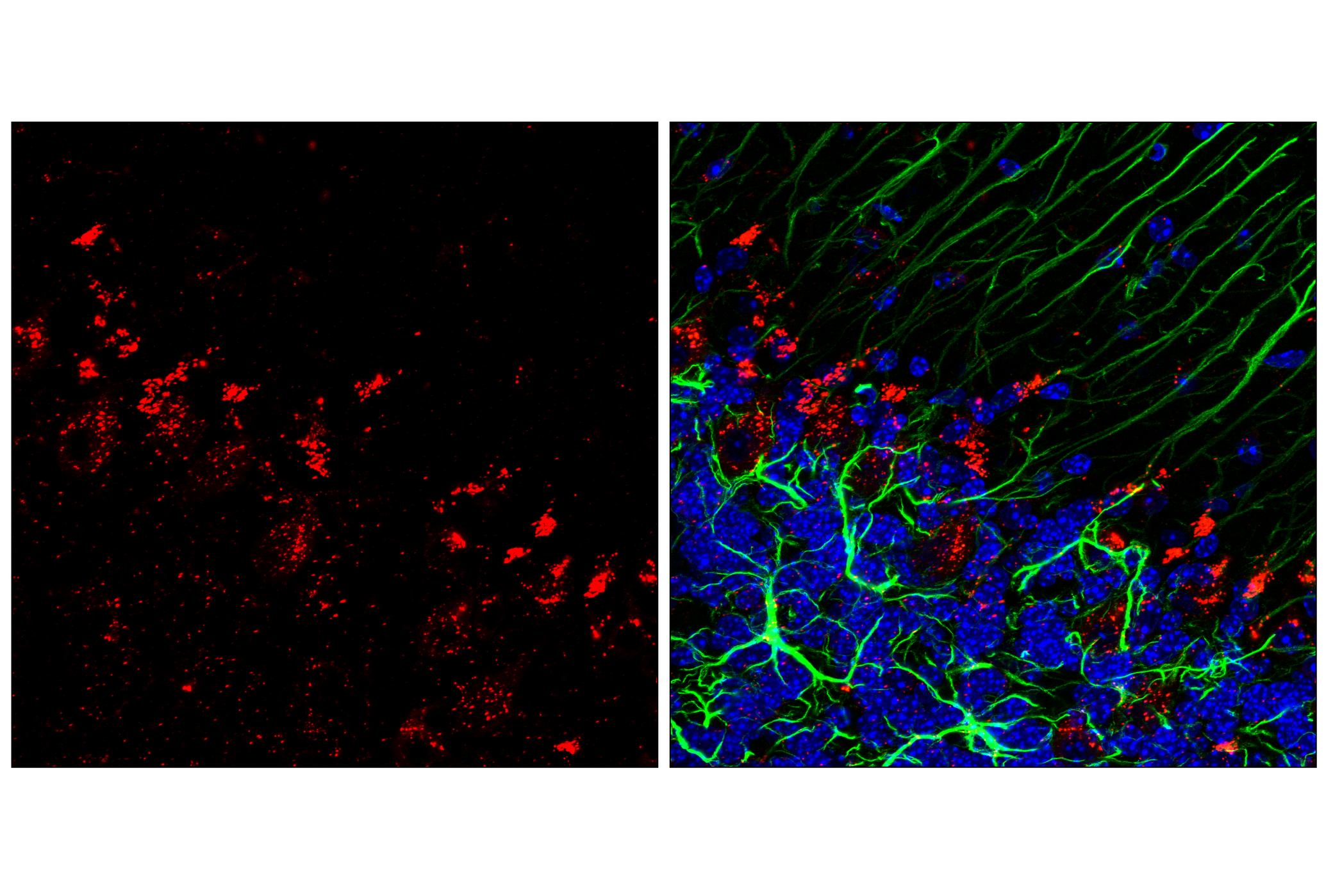 Immunofluorescence Image 1: Cathepsin D (E7Z4L) XP® Rabbit mAb (Alexa Fluor® 647 Conjugate)