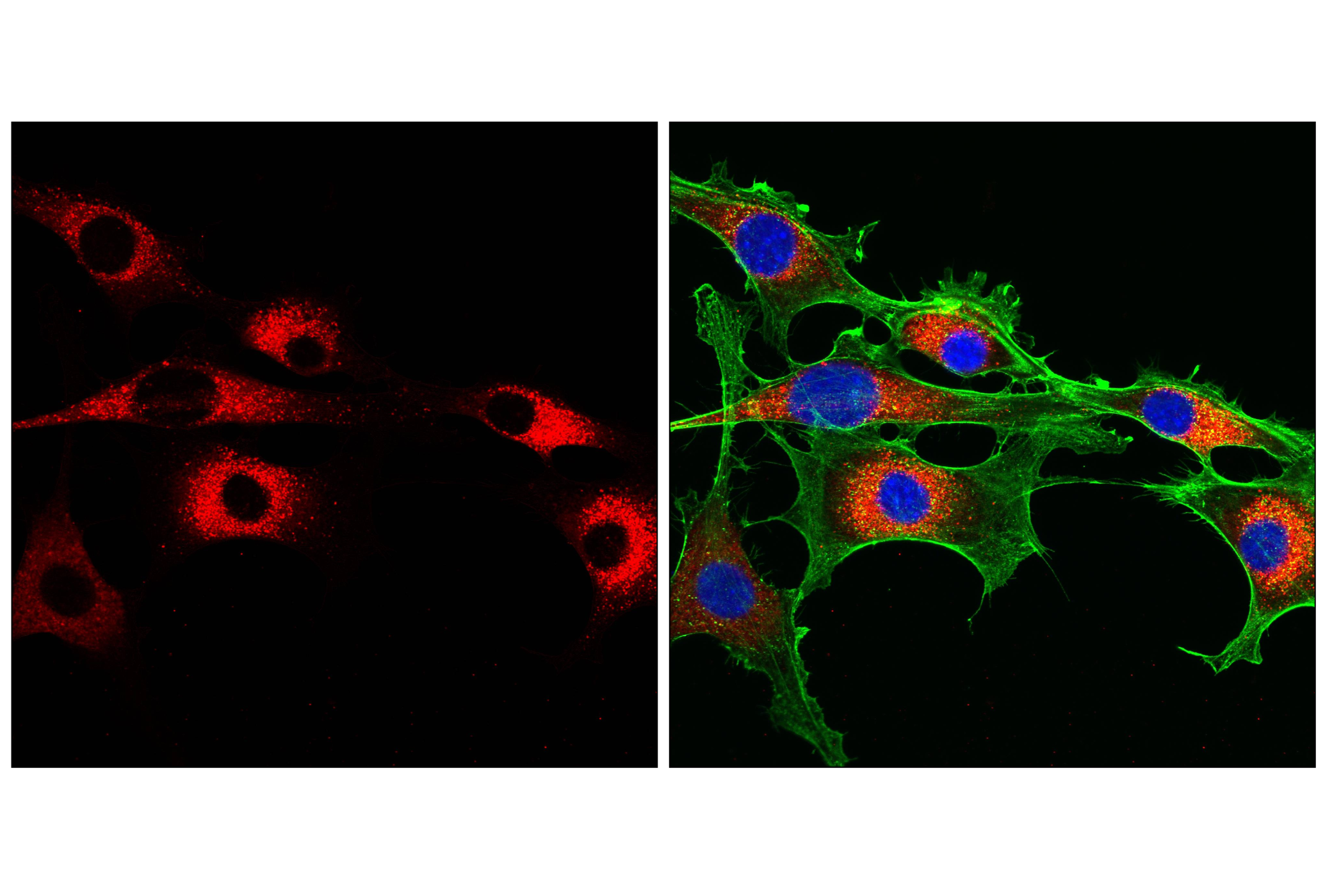 Immunofluorescence Image 2: Cathepsin D (E7Z4L) XP® Rabbit mAb (Alexa Fluor® 647 Conjugate)