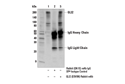 Immunoprecipitation Image 1: GLI2 (E5V8N) Rabbit mAb