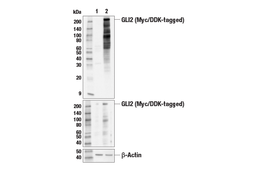  Image 3: Hedgehog Signaling Antibody Sampler Kit