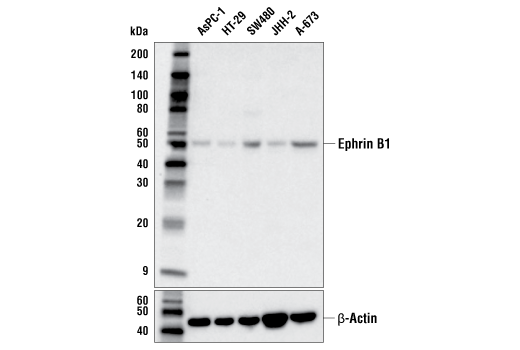 Western Blotting Image 1: Ephrin B1 (E6F4E) Rabbit mAb