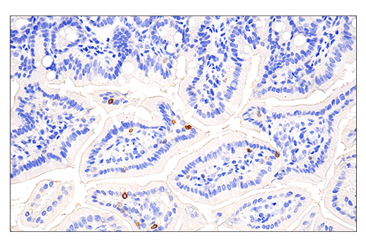 Immunohistochemistry Image 1: 4-1BB/CD137/TNFRSF9 (E2J5H) XP® Rabbit mAb