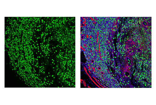 Immunofluorescence Image 1: 4-1BB/CD137/TNFRSF9 (E2J5H) XP® Rabbit mAb