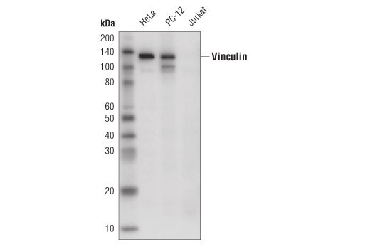 Western Blotting Image 1: Vinculin (E1E9V) XP® Rabbit mAb (HRP Conjugate)