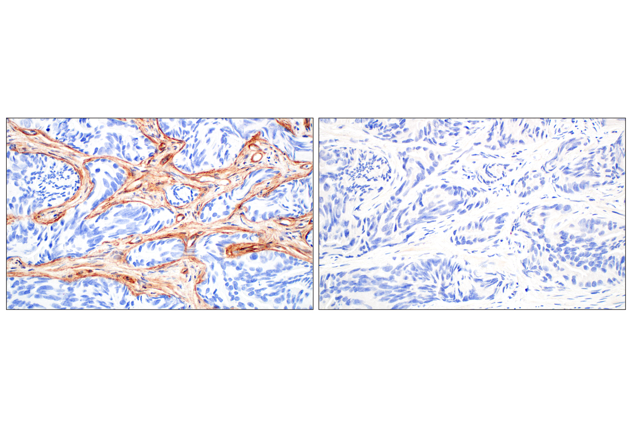 Immunohistochemistry Image 8: COL4A1 (E5M6R) Rabbit mAb (IHC Formulated)