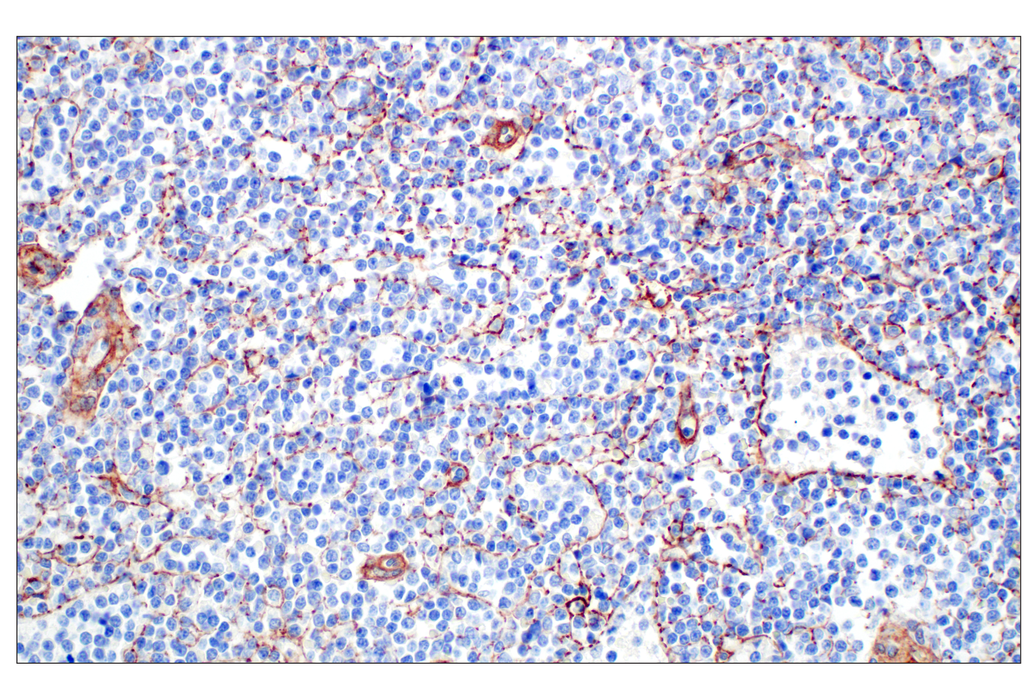 Immunohistochemistry Image 3: COL4A1 (E5M6R) Rabbit mAb (IHC Formulated)