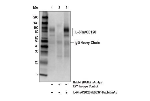 Immunoprecipitation Image 1: IL-6Rα/CD126 (E5B3P) Rabbit mAb