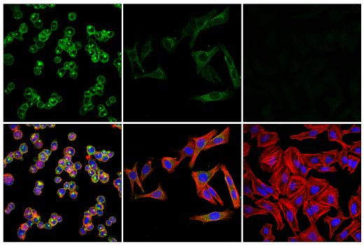 Immunofluorescence Image 1: IL-6Rα/CD126 (E5B3P) Rabbit mAb