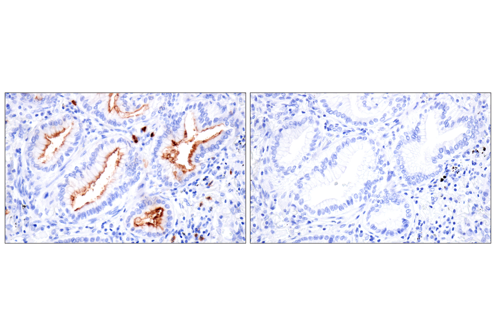 Immunohistochemistry Image 17: CD177 (F9O5U) Rabbit mAb
