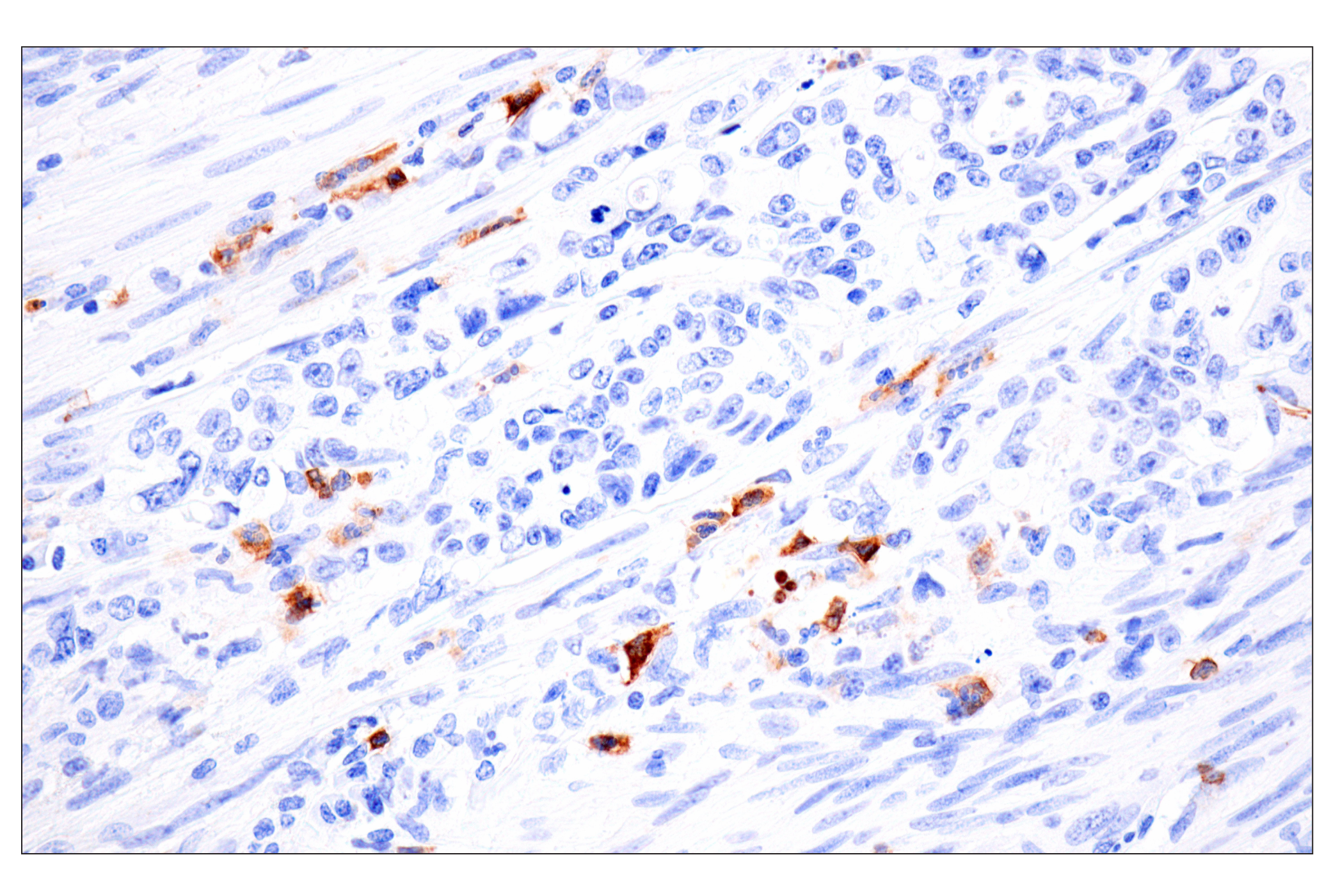 Immunohistochemistry Image 15: CD177 (F9O5U) Rabbit mAb