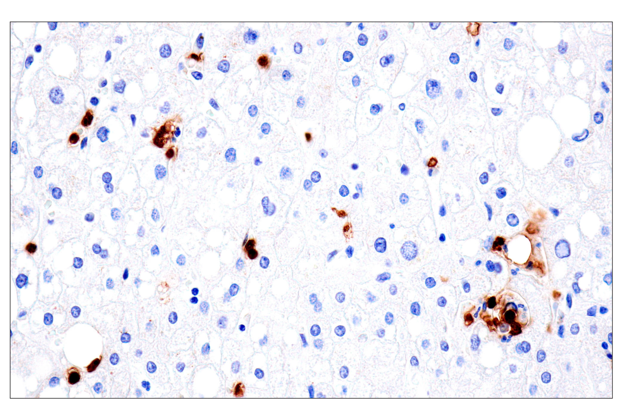 Immunohistochemistry Image 14: CD177 (F9O5U) Rabbit mAb