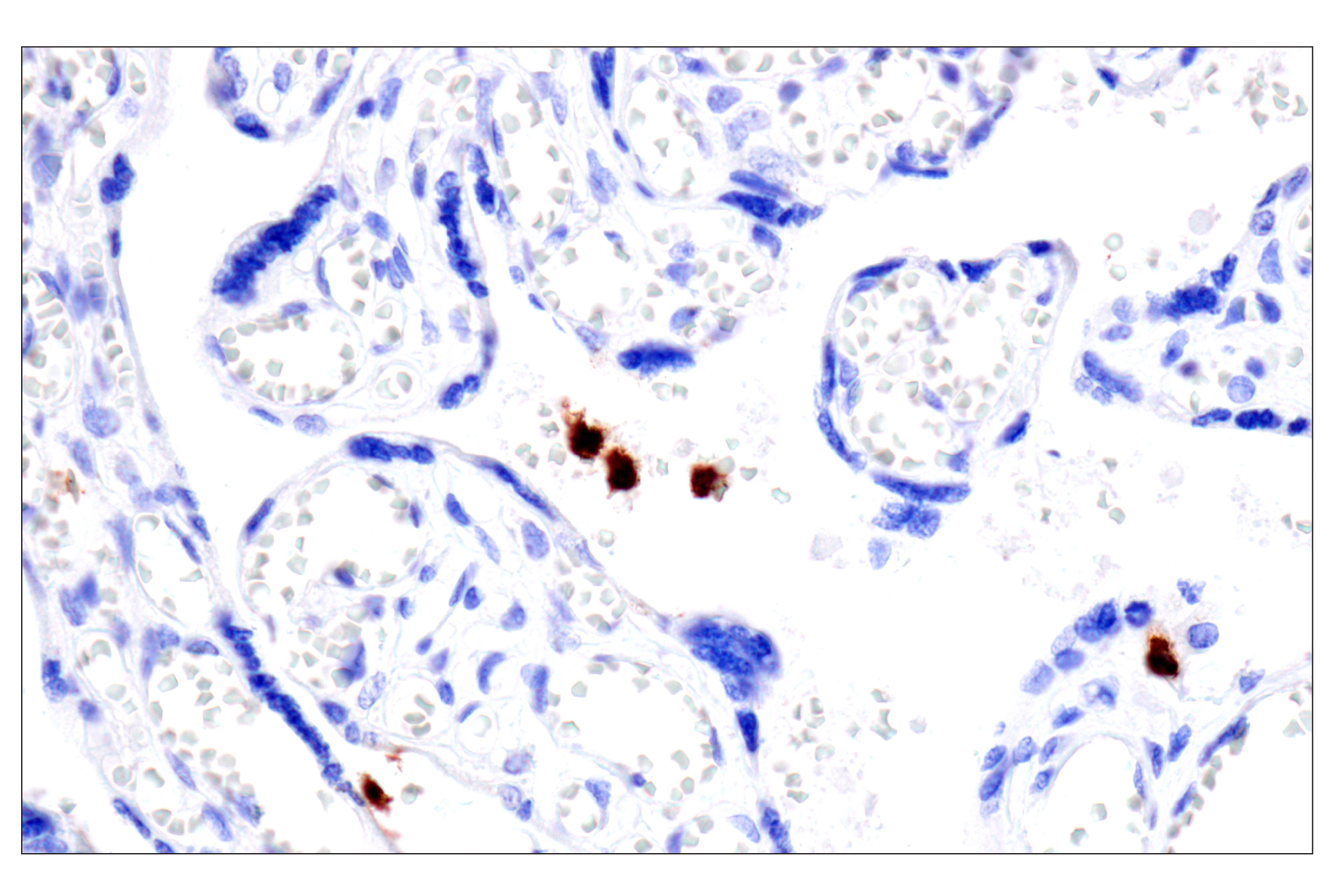 Immunohistochemistry Image 13: CD177 (F9O5U) Rabbit mAb