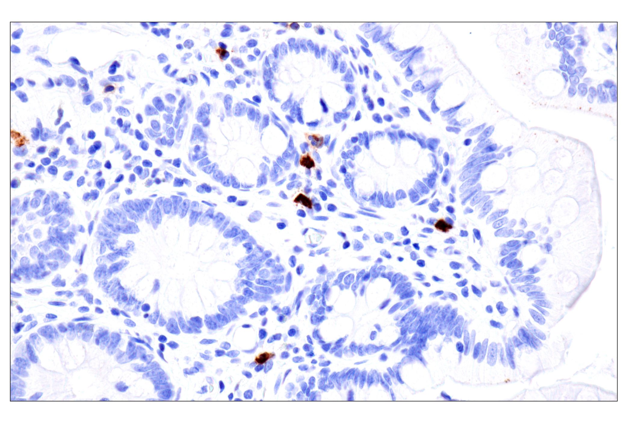 Immunohistochemistry Image 12: CD177 (F9O5U) Rabbit mAb