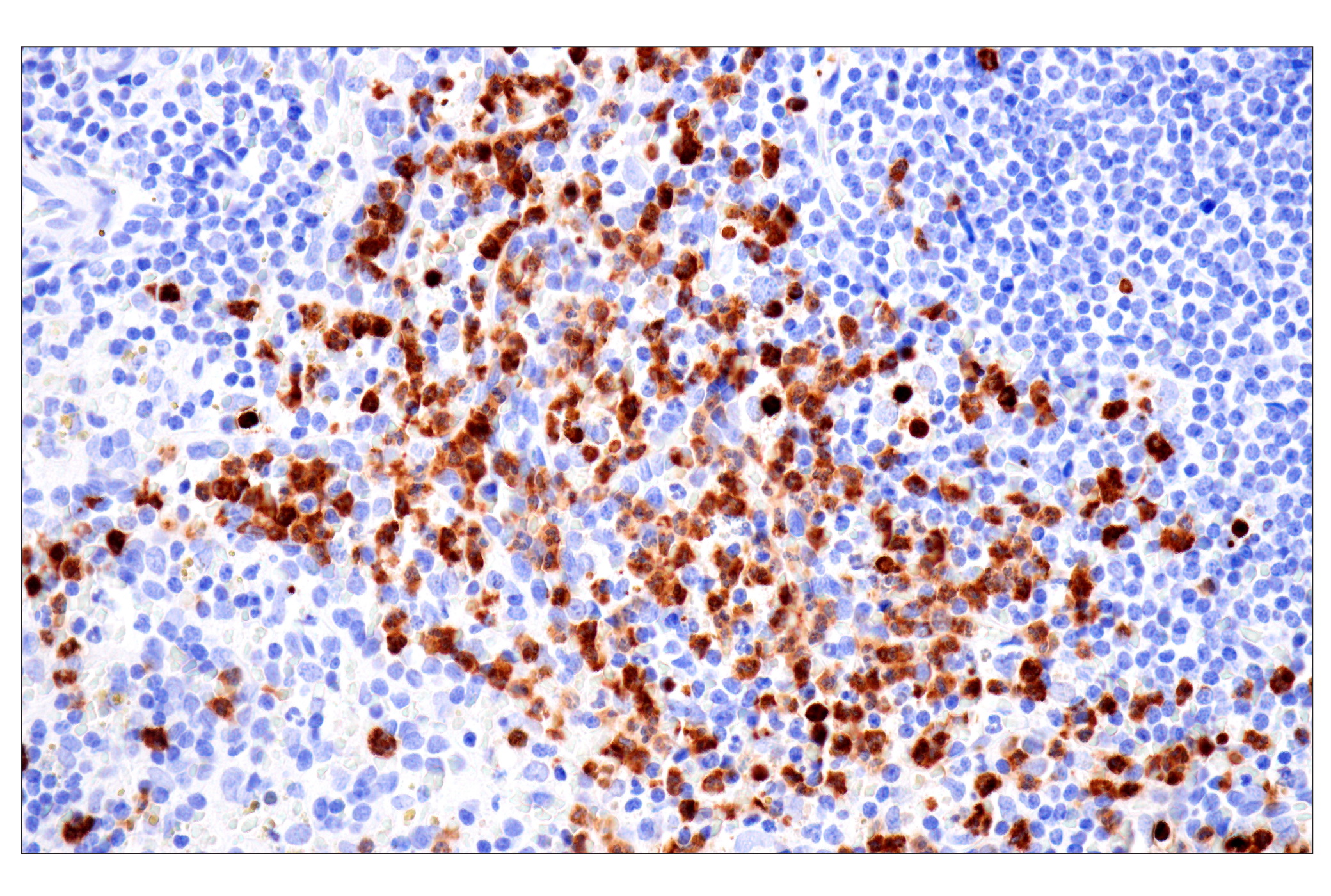 Immunohistochemistry Image 10: CD177 (F9O5U) Rabbit mAb