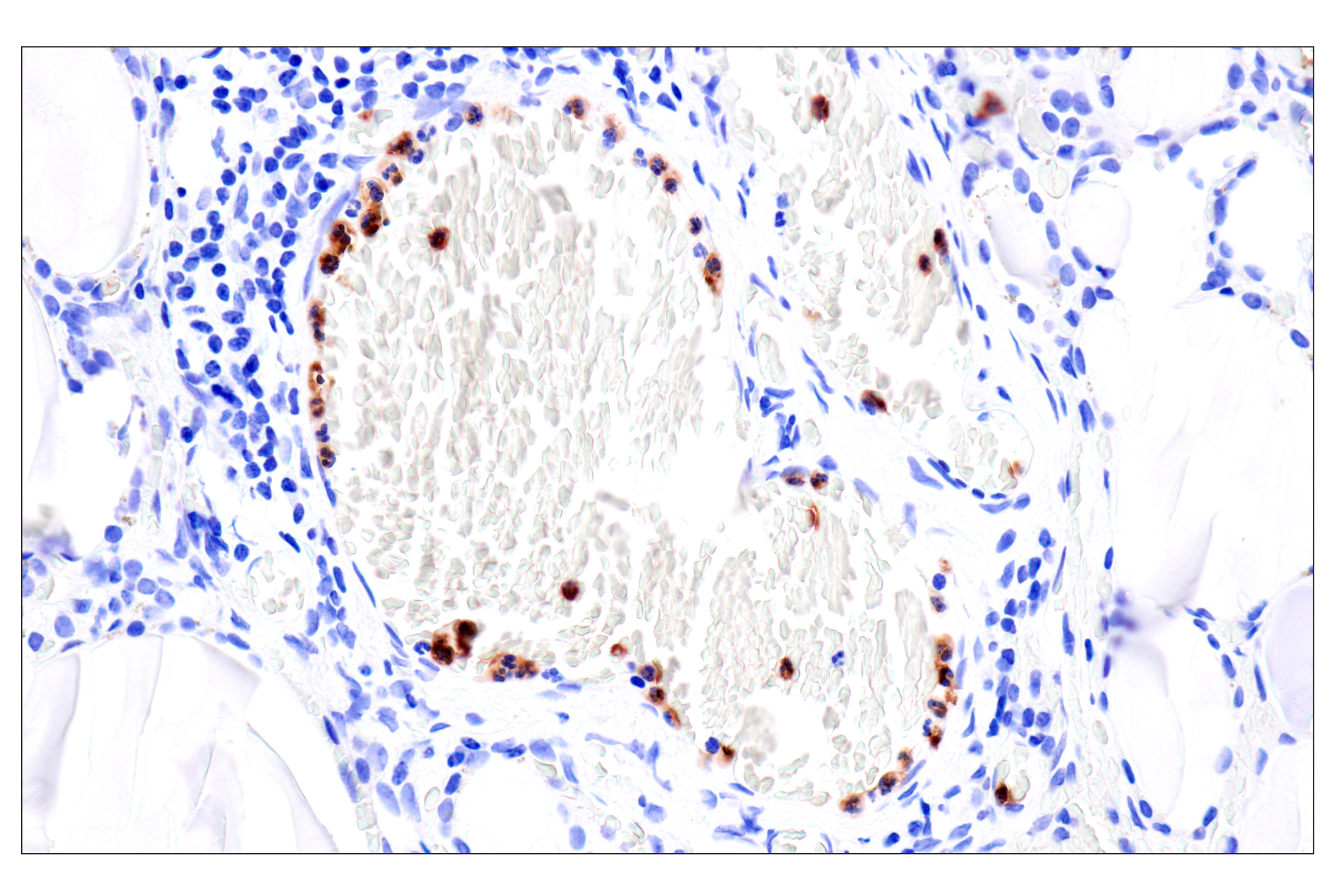 Immunohistochemistry Image 9: CD177 (F9O5U) Rabbit mAb