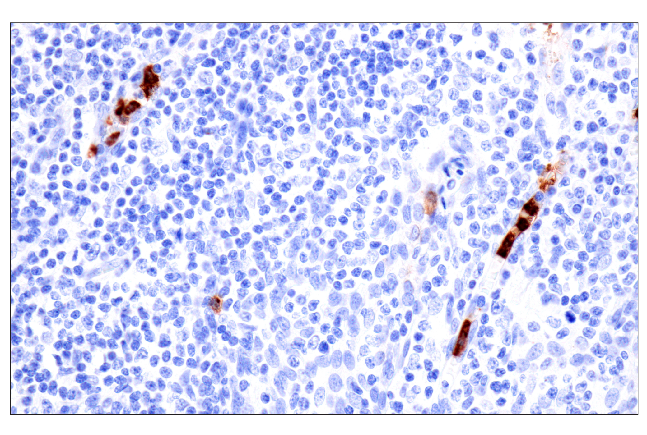 Immunohistochemistry Image 8: CD177 (F9O5U) Rabbit mAb