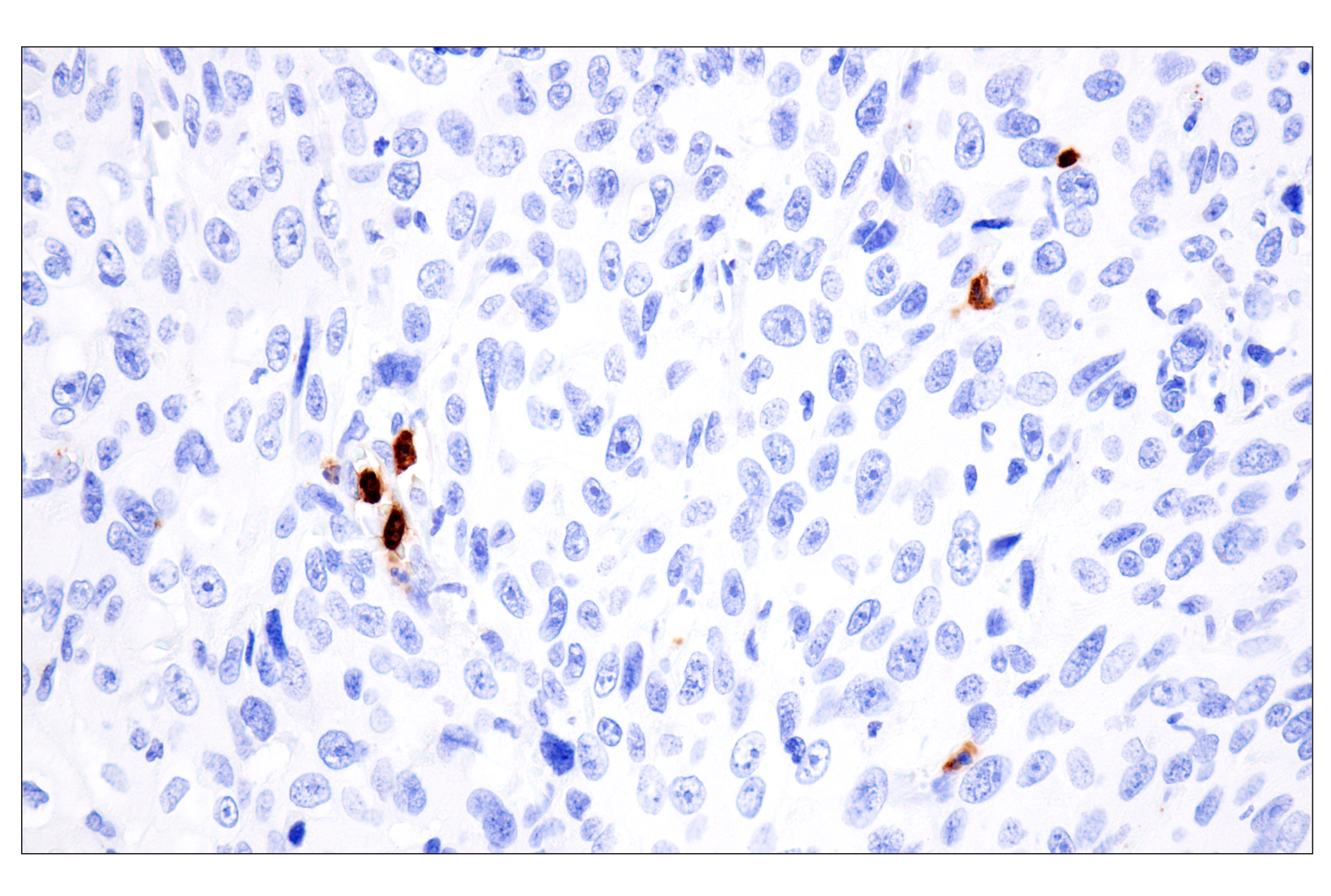 Immunohistochemistry Image 7: CD177 (F9O5U) Rabbit mAb
