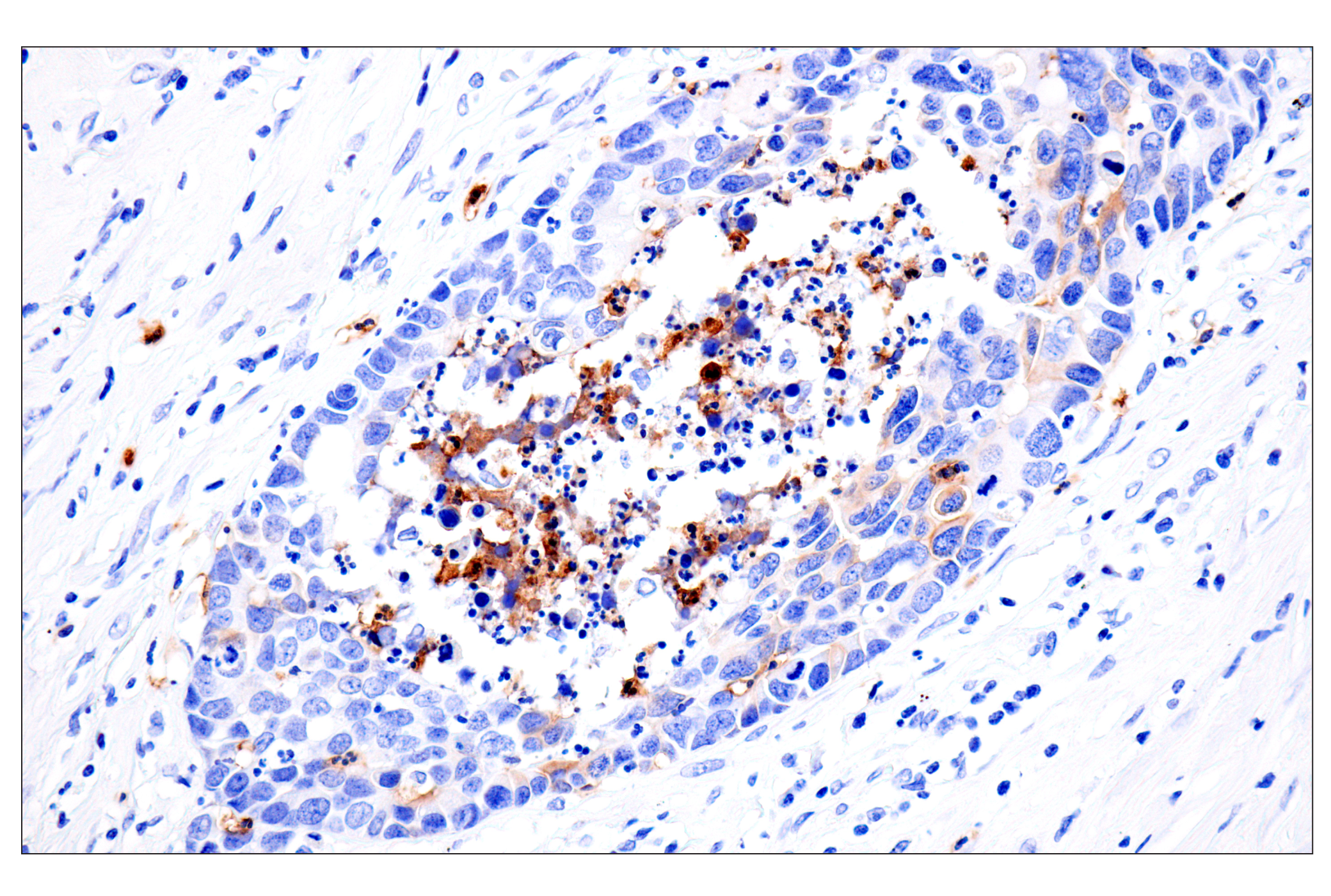 Immunohistochemistry Image 6: CD177 (F9O5U) Rabbit mAb