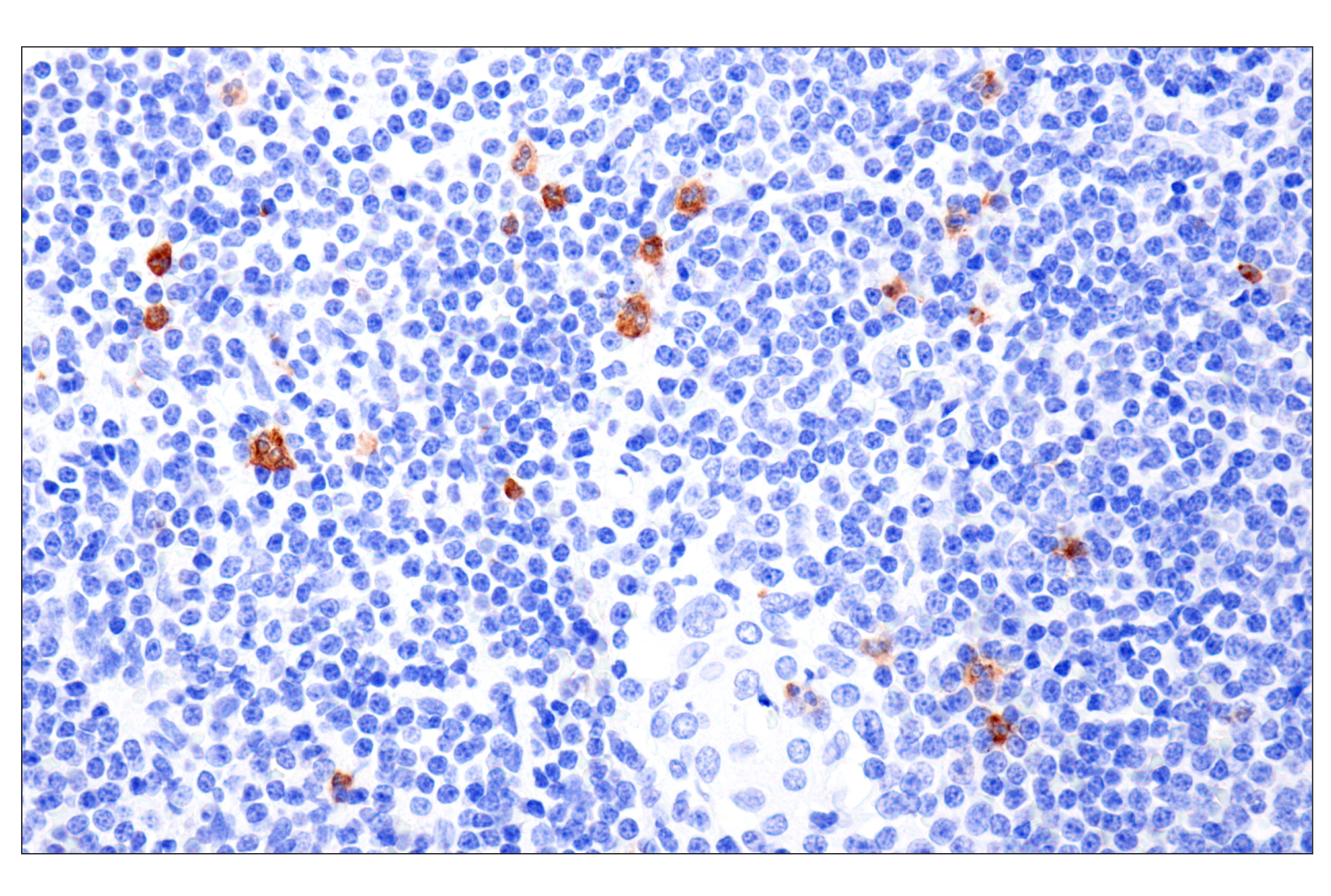 Immunohistochemistry Image 5: CD177 (F9O5U) Rabbit mAb