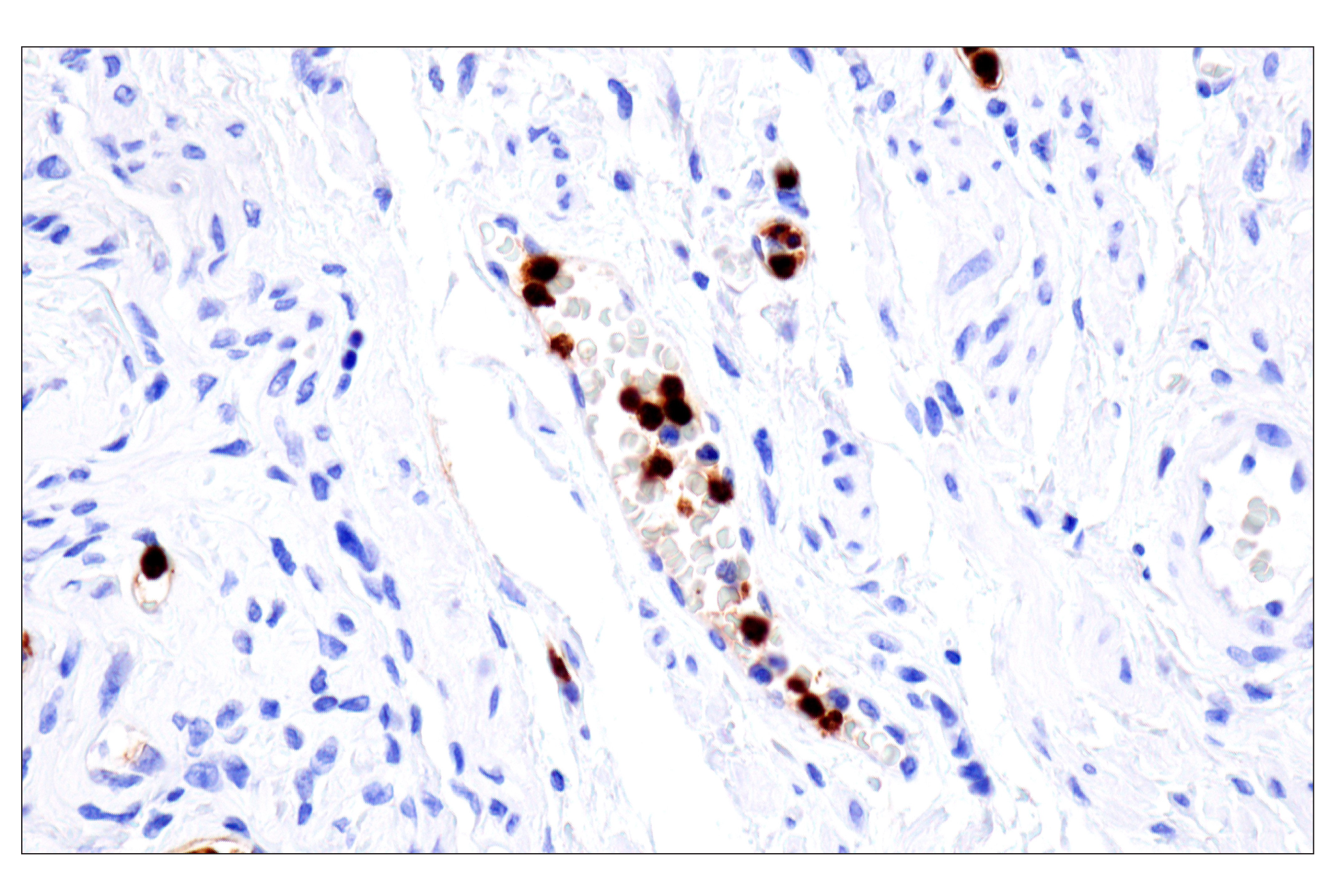 Immunohistochemistry Image 4: CD177 (F9O5U) Rabbit mAb