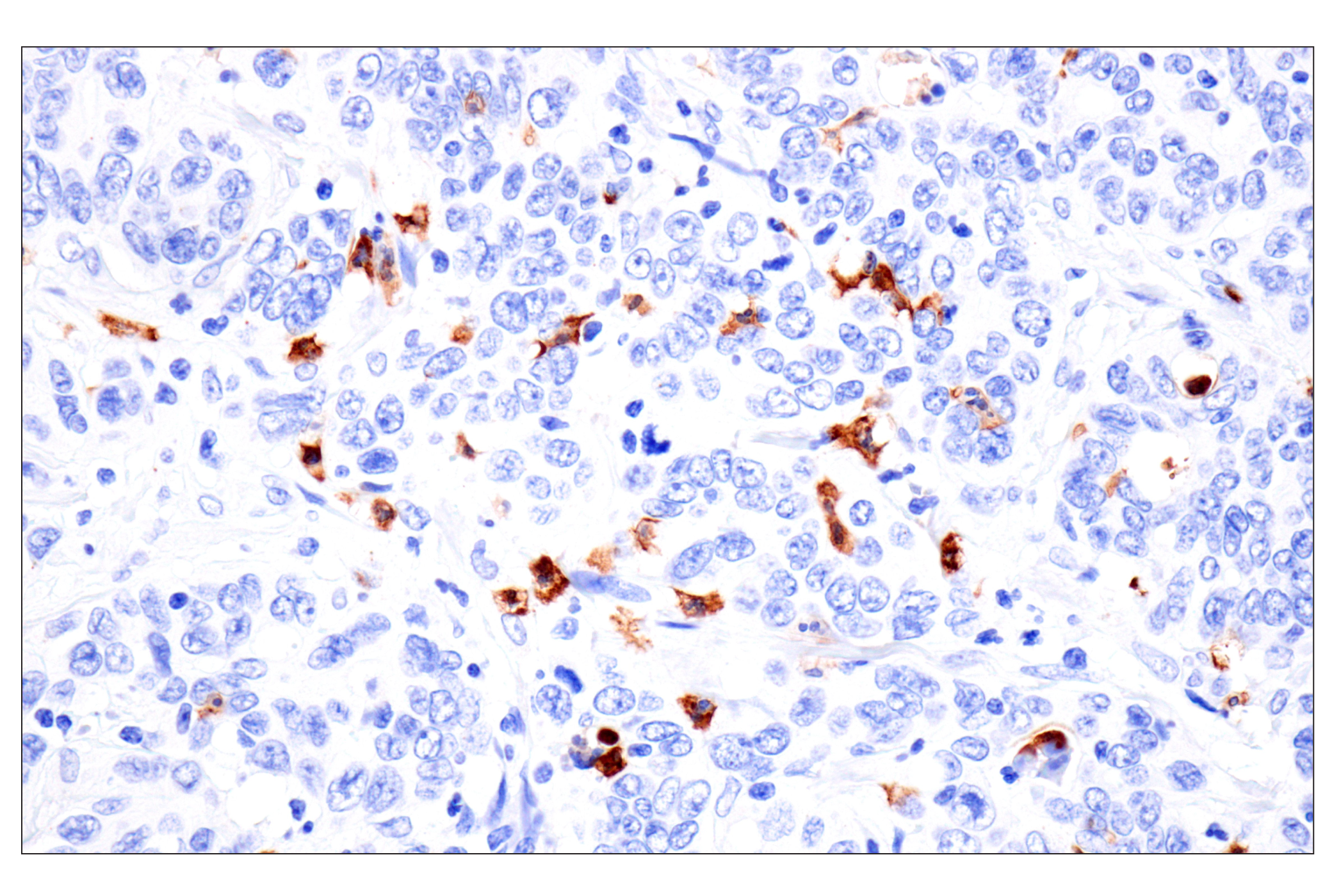 Immunohistochemistry Image 2: CD177 (F9O5U) Rabbit mAb