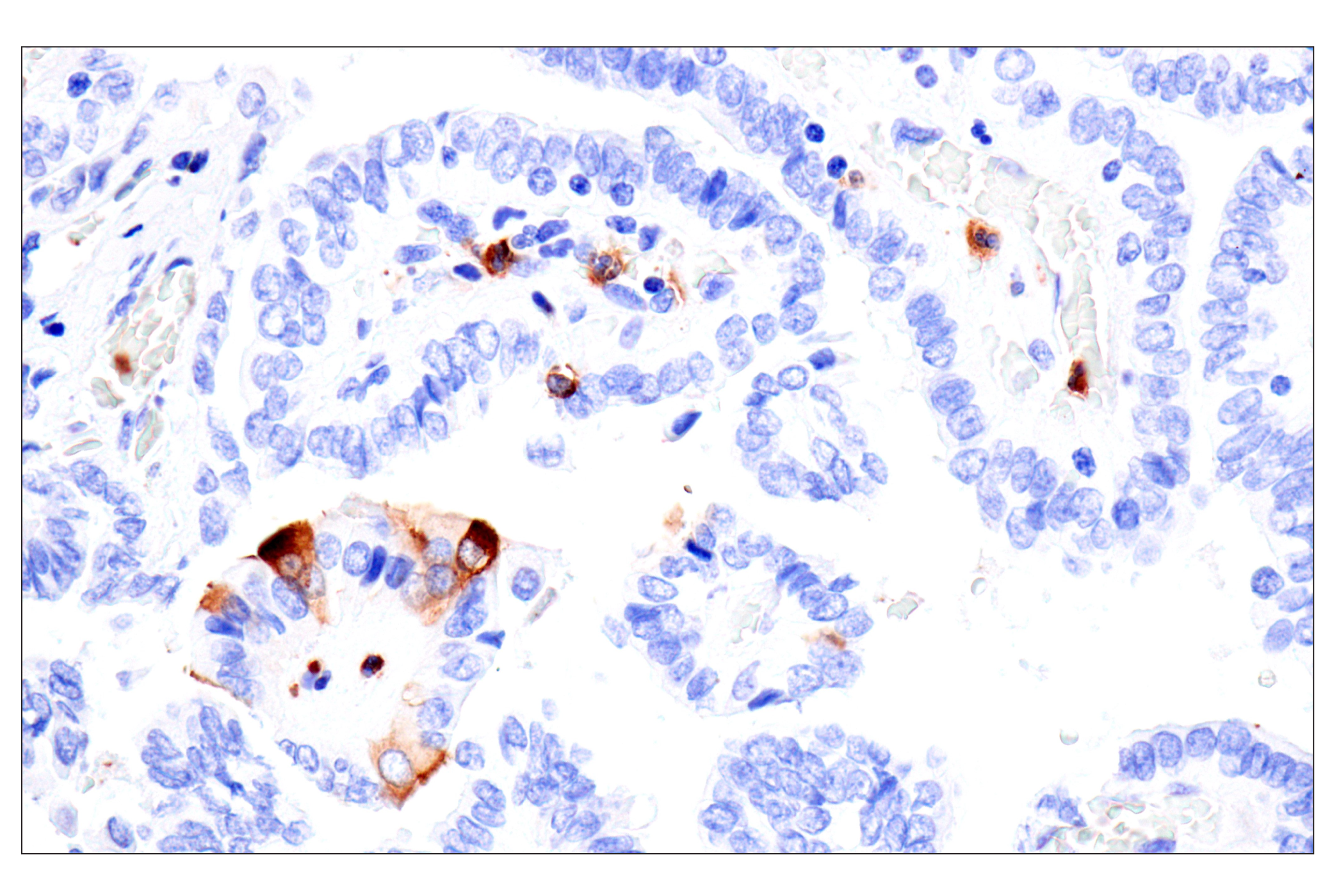 Immunohistochemistry Image 11: CD177 (F9O5U) Rabbit mAb