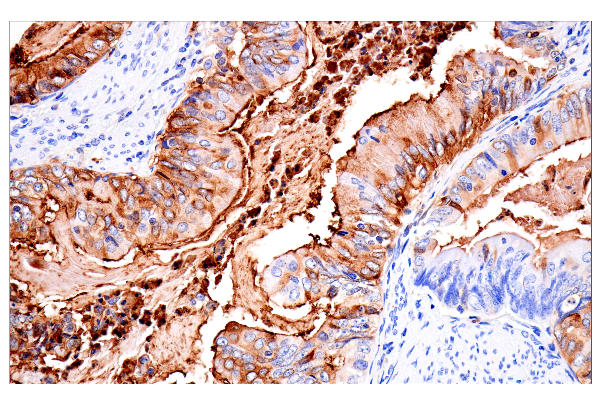 Immunohistochemistry Image 1: CD177 (F9O5U) Rabbit mAb
