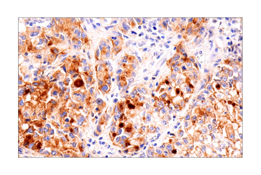 Immunohistochemistry Image 1: MUC16 (IHC125) Mouse mAb