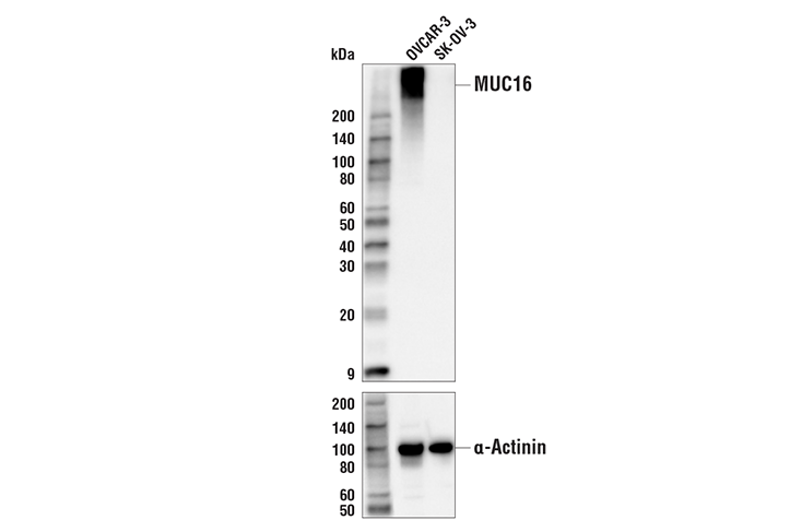 Western Blotting Image 1: MUC16 (IHC125) Mouse mAb
