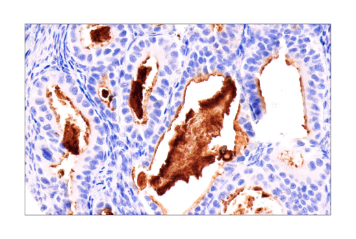 Immunohistochemistry Image 3: MUC16 (IHC125) Mouse mAb