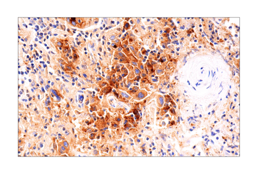 Immunohistochemistry Image 4: MUC16 (IHC125) Mouse mAb