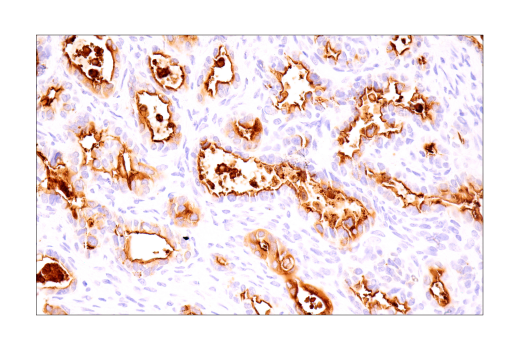 Immunohistochemistry Image 5: MUC16 (IHC125) Mouse mAb