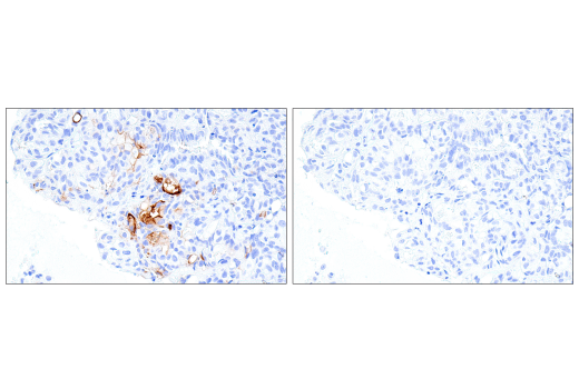 Immunohistochemistry Image 6: MUC16 (IHC125) Mouse mAb