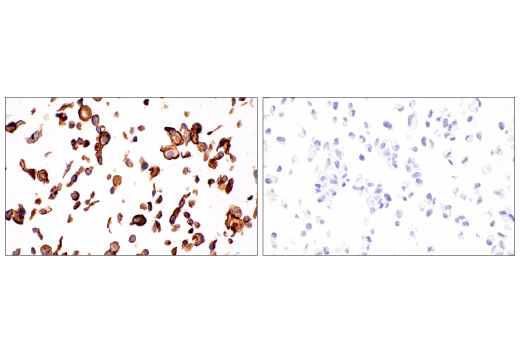 Immunohistochemistry Image 7: MUC16 (IHC125) Mouse mAb
