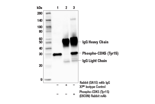 Immunoprecipitation Image 1: Phospho-CDK5 (Tyr15) (E6C8N) Rabbit mAb