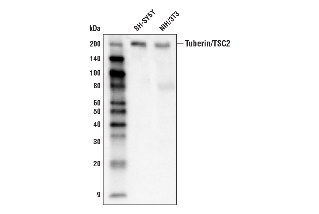 Western Blotting Image 1: Tuberin/TSC2 (D93F12) XP® Rabbit mAb (Biotinylated)