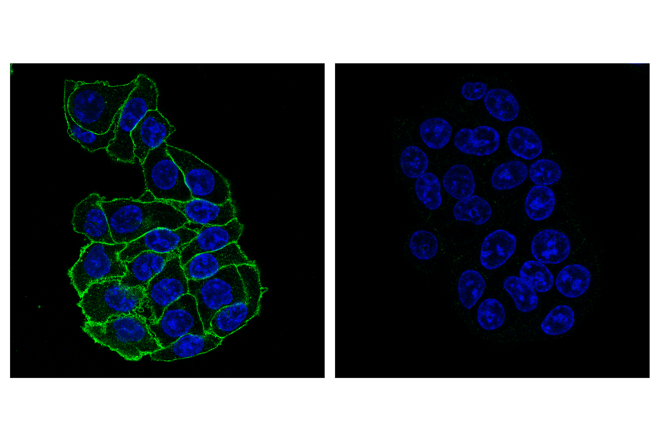 Immunofluorescence Image 1: CMTM6 (E5B1F) Rabbit mAb